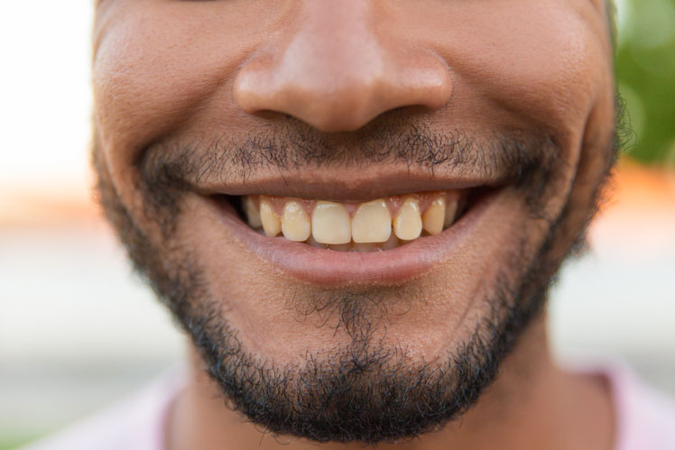 Žluté zuby: je to normální nebo ne?