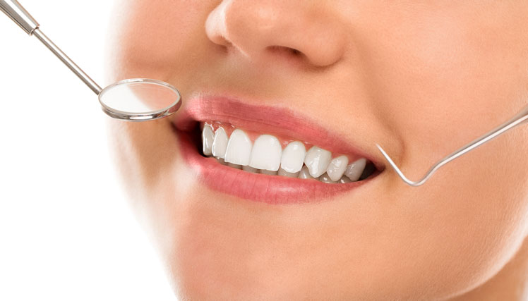 歯に関する一般的な誤解