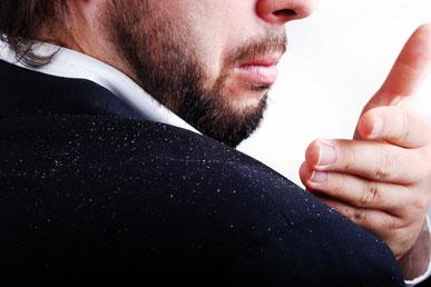 Dandruff: why it appears and how to deal with it